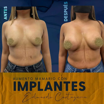 Slider image (6) Dr. Eduardo Cartagena - Plastic Surgeon in Mexico City